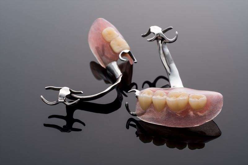 インプラントと入れ歯の違いについてご紹介