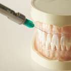 歯医者の麻酔はなぜ痛い？